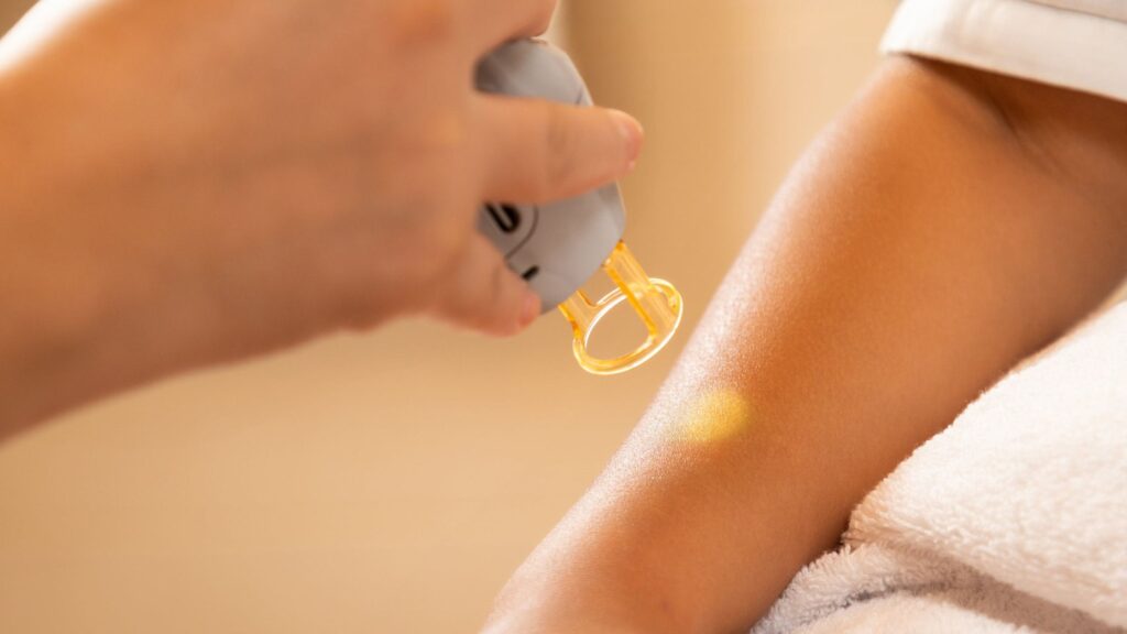 Cold Laser Therapy Langley treatment session at Restore Mobility Physiotherapy